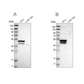 Anti-KRT23 antibody produced in rabbit Prestige Antibodies® Powered by Atlas Antibodies, affinity isolated antibody, buffered aqueous glycerol solution