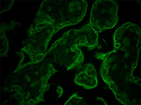 Monoclonal Anti-Cytokeratin Peptide 8 antibody produced in mouse clone M20, ascites fluid