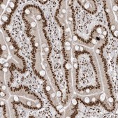Anti-SKIV2L2 antibody produced in rabbit Prestige Antibodies® Powered by Atlas Antibodies, affinity isolated antibody, buffered aqueous glycerol solution