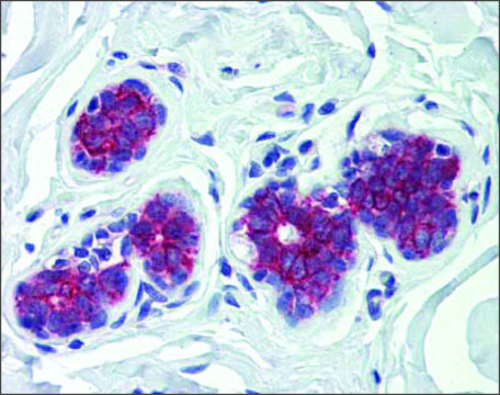 Anti-G6PC affinity isolated antibody