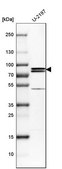 Anti-PNPLA8 antibody produced in rabbit Prestige Antibodies® Powered by Atlas Antibodies, affinity isolated antibody, buffered aqueous glycerol solution
