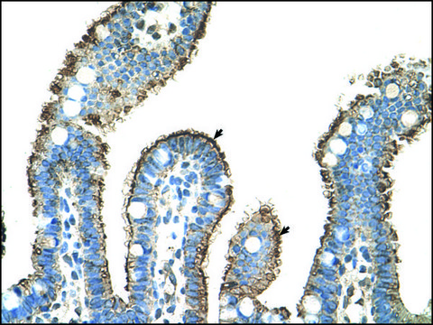 Anti-MMP1 IgG fraction of antiserum