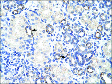 Anti-ZBTB9 (AB1) antibody produced in rabbit affinity isolated antibody