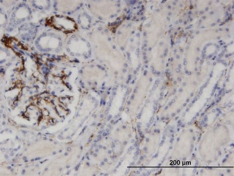 Monoclonal Anti-UPP1, (N-terminal) antibody produced in mouse clone 2F5, purified immunoglobulin, buffered aqueous solution