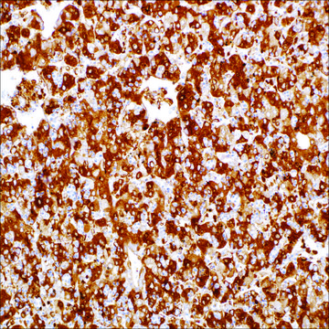 Alpha-Fetoprotein Rabbit Polyclonal Antibody