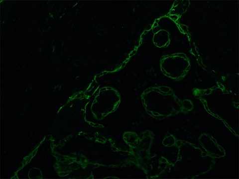 Monoclonal Anti-Cytokeratin Peptide 18 antibody produced in mouse clone KS-B17.2, ascites fluid