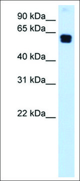 Anti-DOK1 antibody produced in rabbit affinity isolated antibody