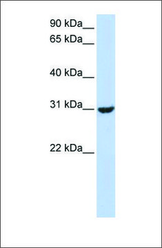 Anti-RNF182 (ab2) antibody produced in rabbit affinity isolated antibody