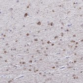 Anti-QDPR antibody produced in rabbit Prestige Antibodies® Powered by Atlas Antibodies, affinity isolated antibody, buffered aqueous glycerol solution