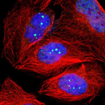 Anti-TP53BP1 antibody produced in rabbit affinity isolated antibody, buffered aqueous glycerol solution