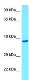 Anti-IL3RA (C-terminal) antibody produced in rabbit affinity isolated antibody