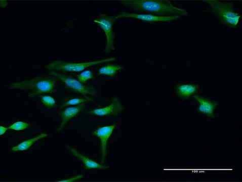 Anti-DTNBP1 antibody produced in rabbit purified immunoglobulin, buffered aqueous solution