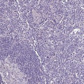 Anti-HTRA4 antibody produced in rabbit Prestige Antibodies® Powered by Atlas Antibodies, affinity isolated antibody, buffered aqueous glycerol solution