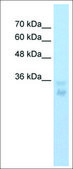 Anti-HOXB5 antibody produced in rabbit affinity isolated antibody