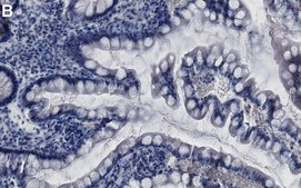 Anti-MGMT Antibody, clone MT3.1 ZooMAb® Mouse Monoclonal recombinant, expressed in HEK 293 cells