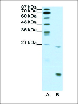 Anti-RUNX1 antibody produced in rabbit affinity isolated antibody