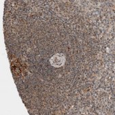 Anti-KLHL6 antibody produced in rabbit Prestige Antibodies® Powered by Atlas Antibodies, affinity isolated antibody, buffered aqueous glycerol solution