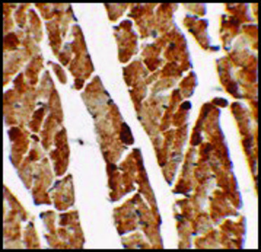 Anti-TGM5 antibody produced in rabbit affinity isolated antibody