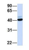 Anti-CCR5 antibody produced in rabbit affinity isolated antibody