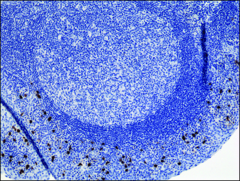 Anti-Human IgA2 antibody, Rabbit monoclonal recombinant, expressed in HEK 293 cells, clone RM125, purified immunoglobulin