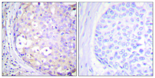 Anti-PKC-PAN antibody produced in rabbit affinity isolated antibody