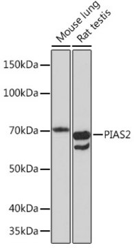 Anti-PIAS2 Antibody, clone 4I6K6, Rabbit Monoclonal