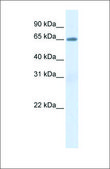 Anti-ALB (ab2) antibody produced in rabbit affinity isolated antibody