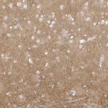 Anti-ARHGEF9 antibody produced in rabbit Prestige Antibodies&#174; Powered by Atlas Antibodies, affinity isolated antibody, buffered aqueous glycerol solution