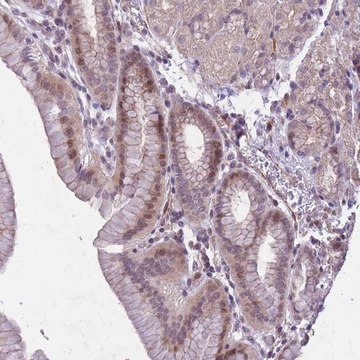 Anti-CBX6 antibody produced in rabbit Prestige Antibodies&#174; Powered by Atlas Antibodies, affinity isolated antibody, buffered aqueous glycerol solution