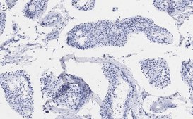 Anti-&#946; Tubulin Antibody, clone 10G11 ZooMAb&#174; Rabbit Monoclonal recombinant, expressed in HEK 293 cells