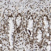Anti-NUMA1 antibody produced in rabbit Prestige Antibodies® Powered by Atlas Antibodies, affinity isolated antibody, buffered aqueous glycerol solution, Ab2