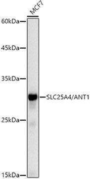 [KO Validated]Anti-SLC25A4/ANT1 Antibody, clone 3C1Q3, Rabbit Monoclonal