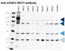 Anti-TMC1 serum, from rabbit