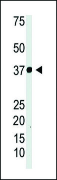 ANTI-IKB ALPHA (IKBA) antibody produced in rabbit IgG fraction of antiserum, buffered aqueous solution