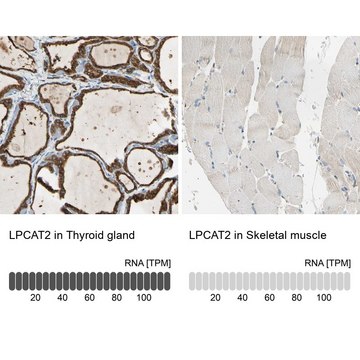 抗-LPCAT2 兔抗 Prestige Antibodies&#174; Powered by Atlas Antibodies, affinity isolated antibody, buffered aqueous glycerol solution