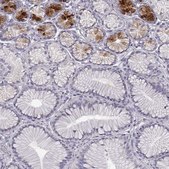 Anti-B3GNT6 antibody produced in rabbit Prestige Antibodies® Powered by Atlas Antibodies, affinity isolated antibody, buffered aqueous glycerol solution