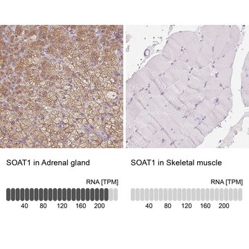 Anti-SOAT1 antibody produced in rabbit Prestige Antibodies&#174; Powered by Atlas Antibodies, affinity isolated antibody, buffered aqueous glycerol solution