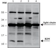 Anti-B2M antibody, Mouse monoclonal clone 92A, purified from hybridoma cell culture