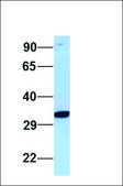 Anti-RHD antibody produced in rabbit affinity isolated antibody