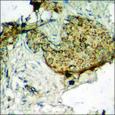 Anti-phospho-IKK-α/β (pSer180/181) antibody produced in rabbit affinity isolated antibody