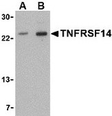 Anti-TNFRSF14 antibody produced in rabbit affinity isolated antibody