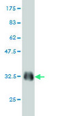 Monoclonal Anti-EML4 antibody produced in mouse clone 3C10, purified immunoglobulin, buffered aqueous solution