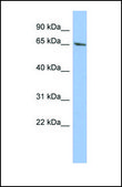 Anti-WT1 affinity isolated antibody