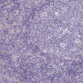 Anti-SPHKAP antibody produced in rabbit Prestige Antibodies® Powered by Atlas Antibodies, affinity isolated antibody, buffered aqueous glycerol solution