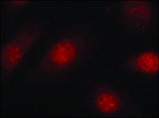 Anti-phospho-RB1 (pSer780) antibody produced in rabbit affinity isolated antibody