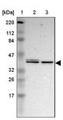 Anti-MAPK3 antibody produced in rabbit Ab2, Prestige Antibodies® Powered by Atlas Antibodies, affinity isolated antibody, buffered aqueous glycerol solution