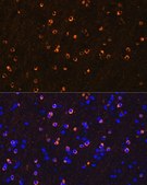 Anti-NMDAR1 antibody produced in rabbit