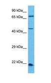 Anti-USP12 antibody produced in rabbit affinity isolated antibody