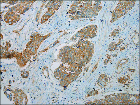 Anti-TMEM123 affinity isolated antibody