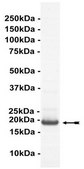 UbcH5a Protein, active, 50 µg Active, full length, recombinant human UbcH5a. N-terminal HA, 6His-tagged. For use in Enzyme Assays. Functions as an E2 enzyme in ubiquitination assays.